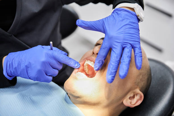 Best Emergency Dental Care for Broken or Chipped Teeth in Leisure City, FL